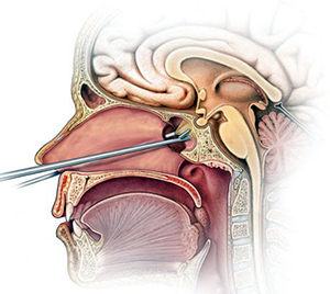 Graphic showing placement of pituitary gland in the head
