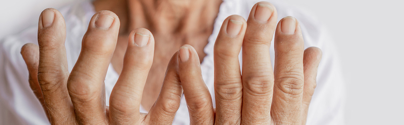 Managing Rheumatic Conditions in Primary Care