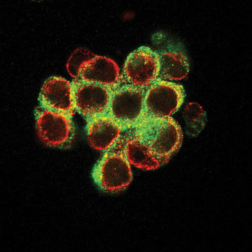 Spheroid of ovarian cancer cells growing in 3D