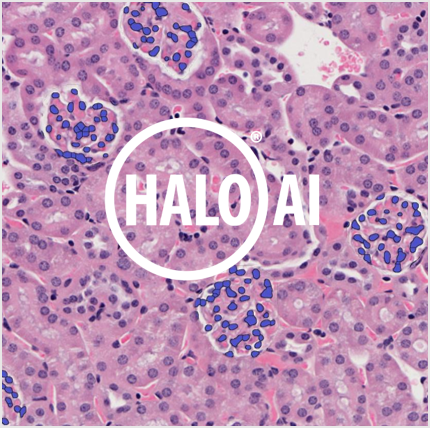 Photo of Halo logo over kidney H&E