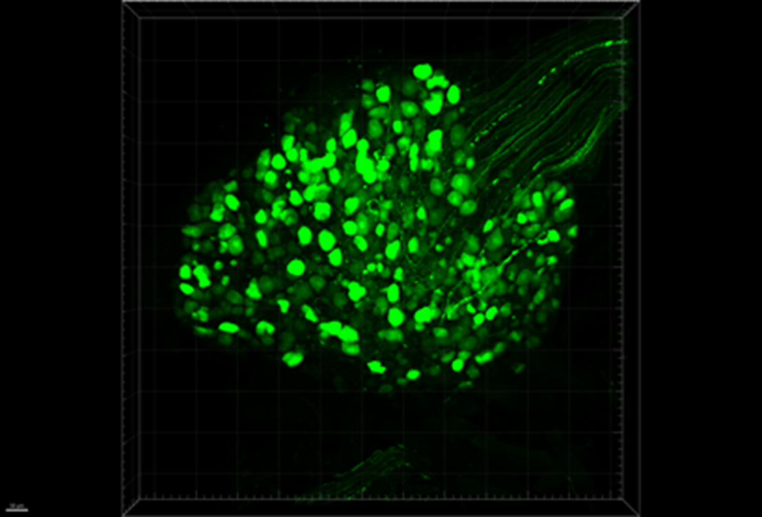 DRG cell bodies and axons expressing GFP.