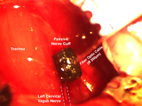 Implanted Passive Nerve Cuff Around the Left Cervical Vagus Nerve of a Mouse