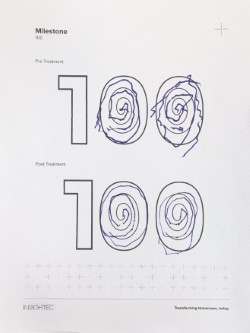 Spiral examples from the 100th HIFU case at CU Anschutz.