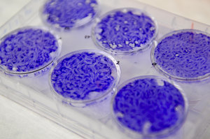 Petri dishes with purple specimens.