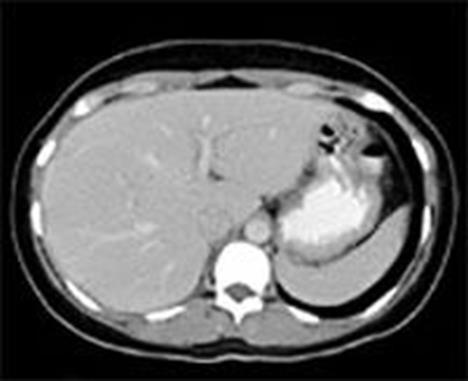 Abdominal Imaging