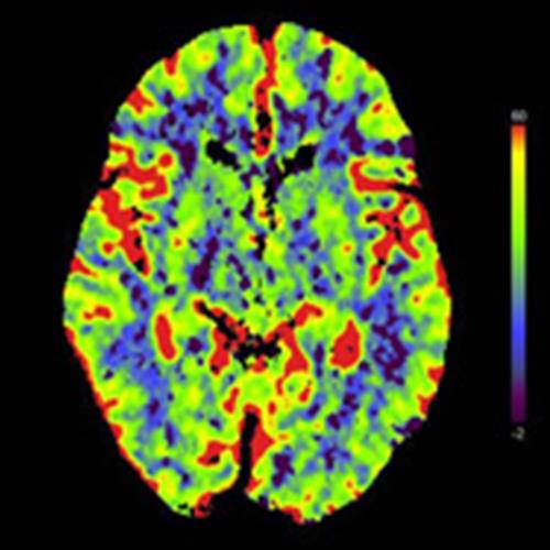 Neuroradiology