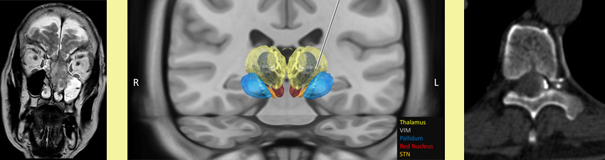 Neuroradiology images