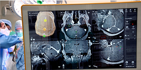 brainimaginginsurgery