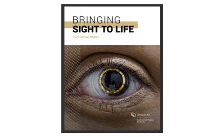 eyeballwithgoldringiris