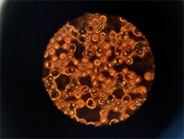 bloodcellsundermicroscope