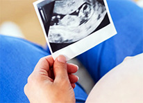 pregnant woman holding ultrasound photo