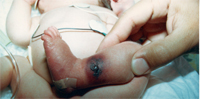 bonds-infant-foot