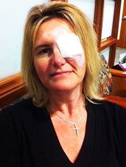 BrigetteDouglasswitheyepatch