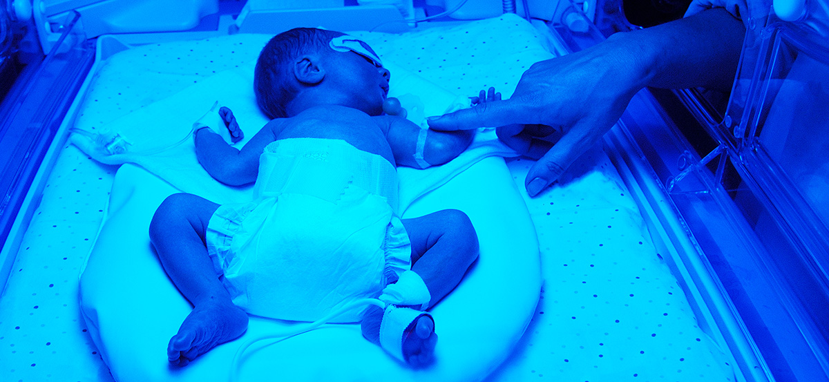 BabyinNicUbathedinbluelight