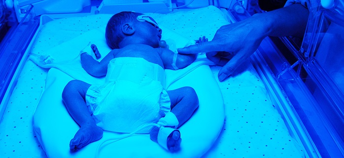 BabyinNicUbathedinbluelight