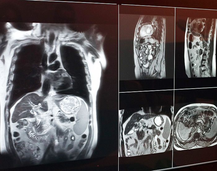 radiationimagesinsurgery
