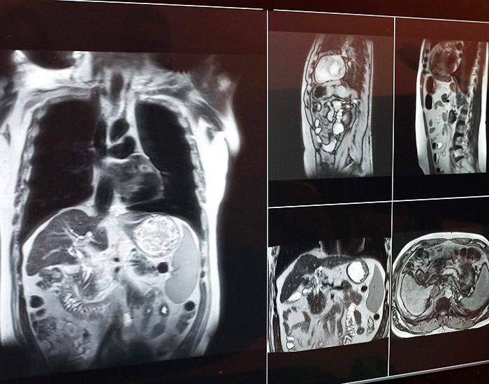 radiationimagesinsurgery