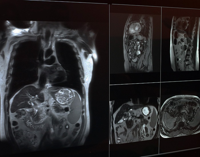 x-rayimages