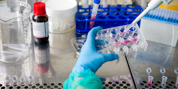 New AACR Report Cites Real Progress Against Cancer, But Also Stubborn Risks and Potential Threats