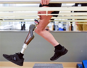 patientexercisingwithprosthesis