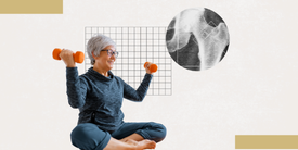 Research Investigates Sarcopenia’s Importance in Postmenopausal Health