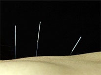 acupuncure-206