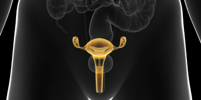 X-ray Ovarian Cancer
