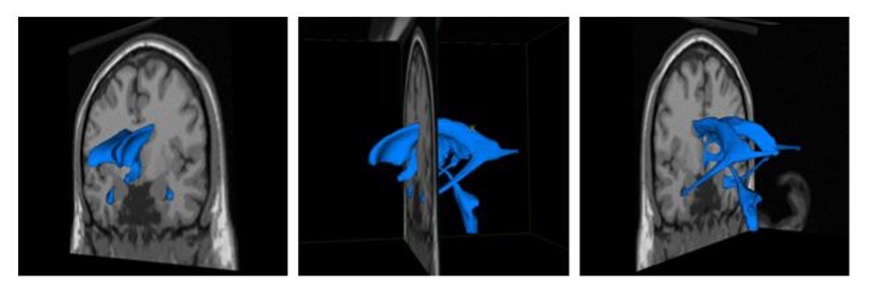 MRI interactive software