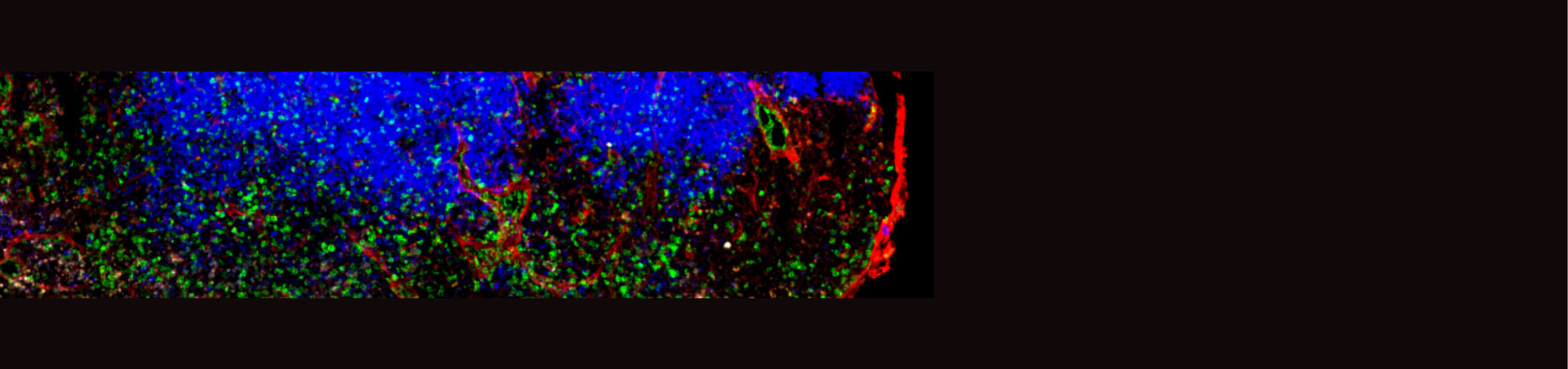 BannerwithblackbackgroundandasectionofascientificimageofamouselymphnodeinoculationwithBCellslitupinblueTCellslitupingreenandFibroblastlitupinRed