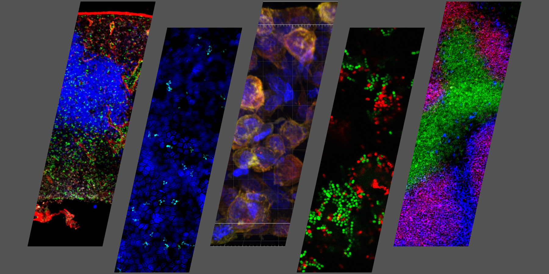 slantedimagesfromimmumicroresearchers