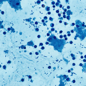 Microscopicviewofbluestainedcellsandrod-shapedbacteriaagainstalighterbluebackground