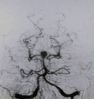 Neurovascular Page