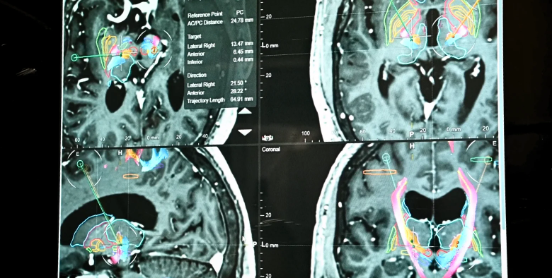 MRI scans on a screen
