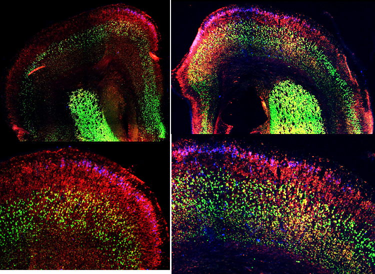 P2 BFE electroporated mouse cortex
