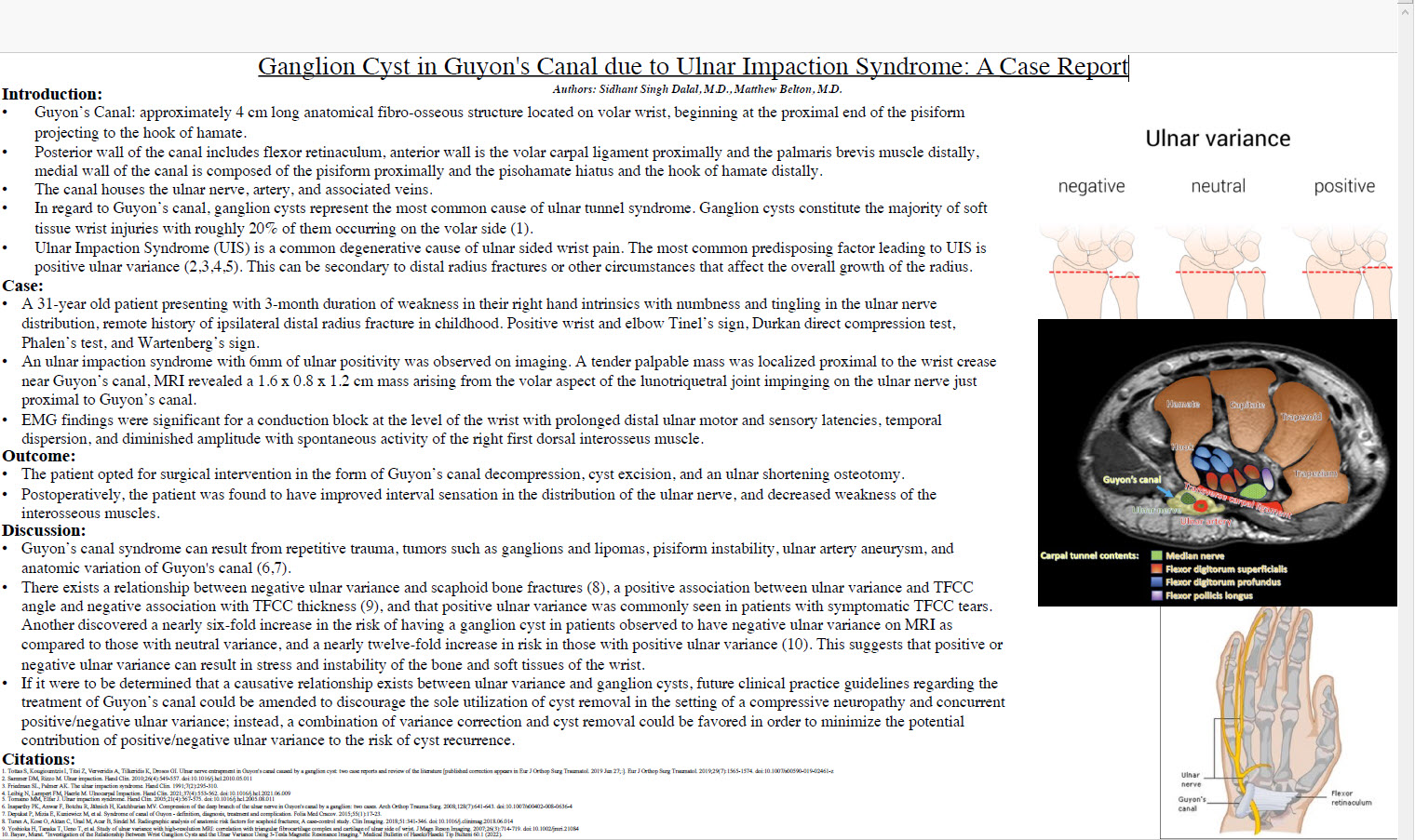 Ganglion Cyst in Guyons Canal due to Ulnar Impaction Syndrome-A Case Report