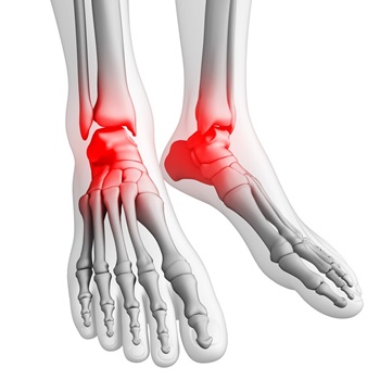 Foot Pain,  T.Jay Kleeman, MD, Foot & Ankle Specialist