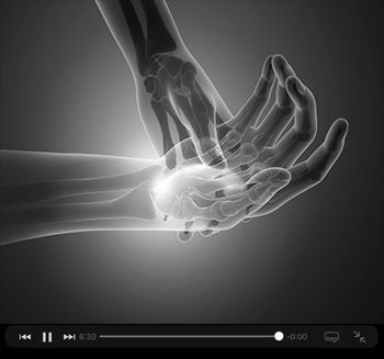 Hand-Wrist-Dr. Andrew Federer, Hand Surgeon