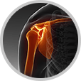 Shoulder Pain, Sports Medicine