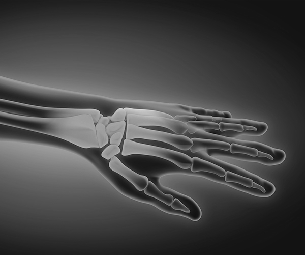 Wrist specialty