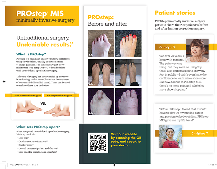 PROstep MIS Patient Brochure 