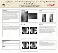 Diaphyseal Femur Fracture Management in an Elderly Patient with Achondroplasia