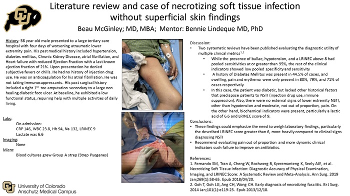 Literature review and case of necrotizing soft tissue infection without superficial skin findings_McGinley-1