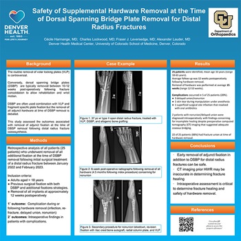 Safety of Supplemental Hardware Removal at the Time of Dorsal Spanning Bridge Plate Removal for Distal Radius Fractures