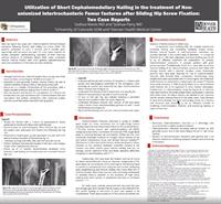 Utilization of Short Cephalomedullary Nailing in the Treatment of Non-unionized Intertrochanteric Femur Fractures after Sliding Hip Screw Fixation