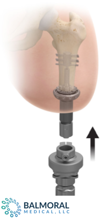 Transdermal Compress Device- Balmoral Logo