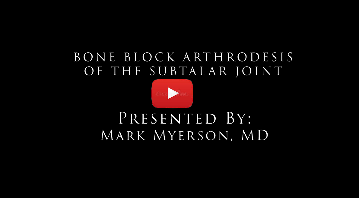 Bone Block Arthrodesis of the Subtalar Joint, Mark Myerson, MD