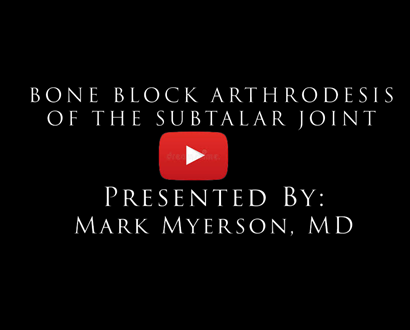 Bone Block Arthrodesis of the Subtalar Joint, Mark Myerson, MD