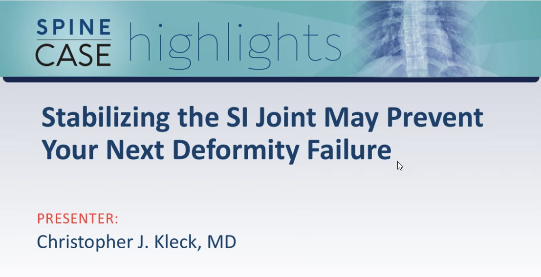 Stabilizing the SI Joint May Prevent Your Next Deformity Failure