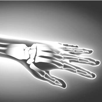 Wrist Pain,  Orthopedic Surgeons and Specialists