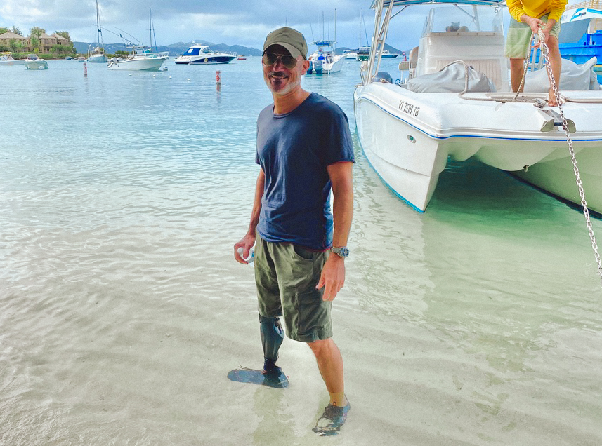 University-Colorado-Osseointegration-Prosthetic-Stoneback-Limb-Restoration-24